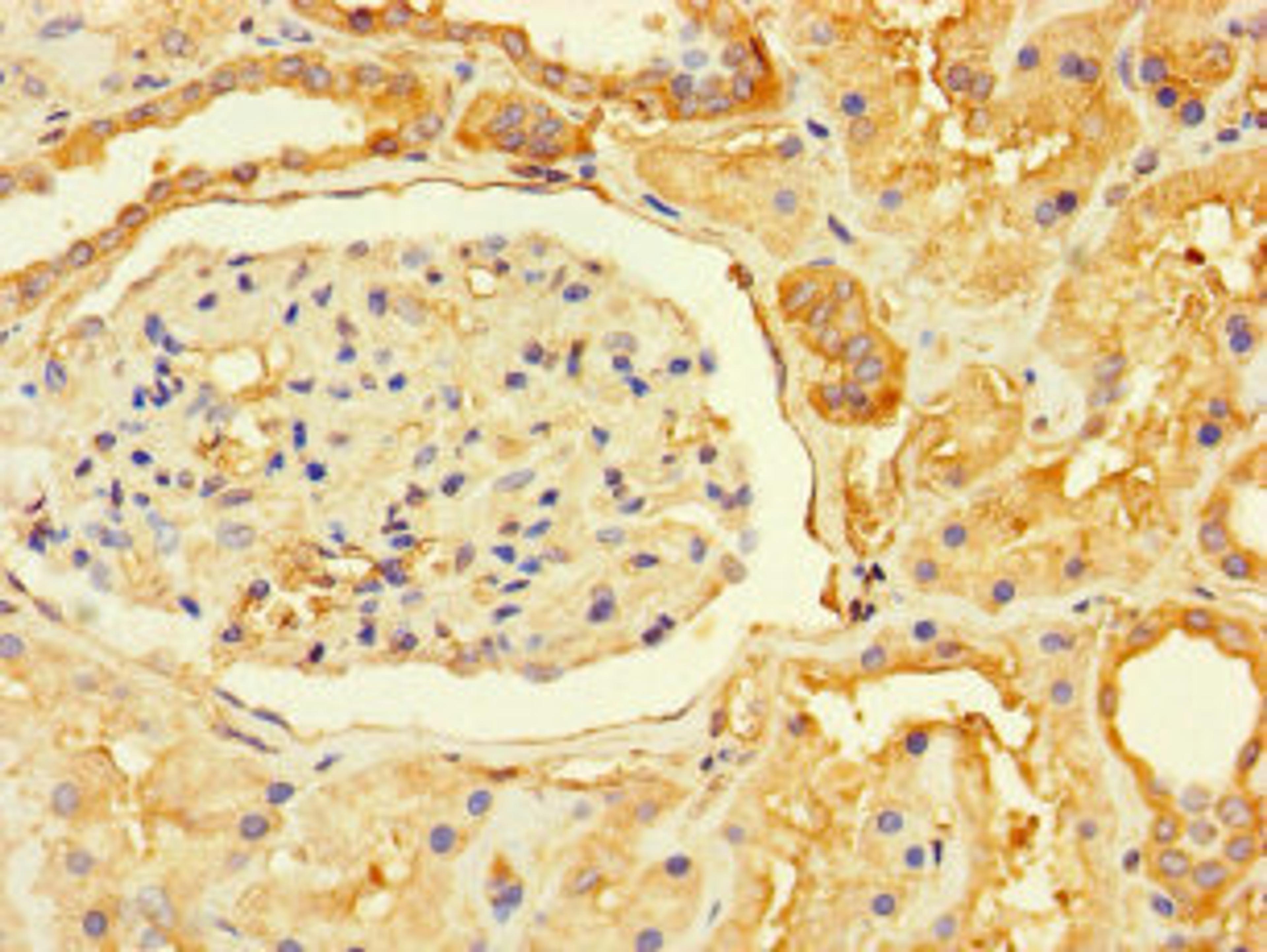 Immunohistochemistry of paraffin-embedded human kidney tissue using CSB-PA856999LA01HU at dilution of 1:100