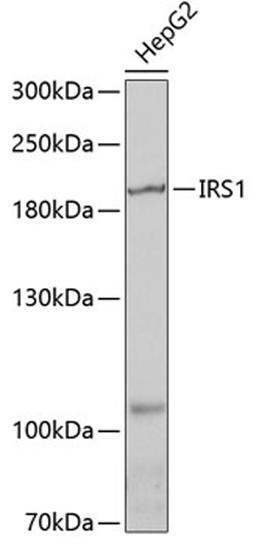 Western blot - IRS1 antibody (A0245)