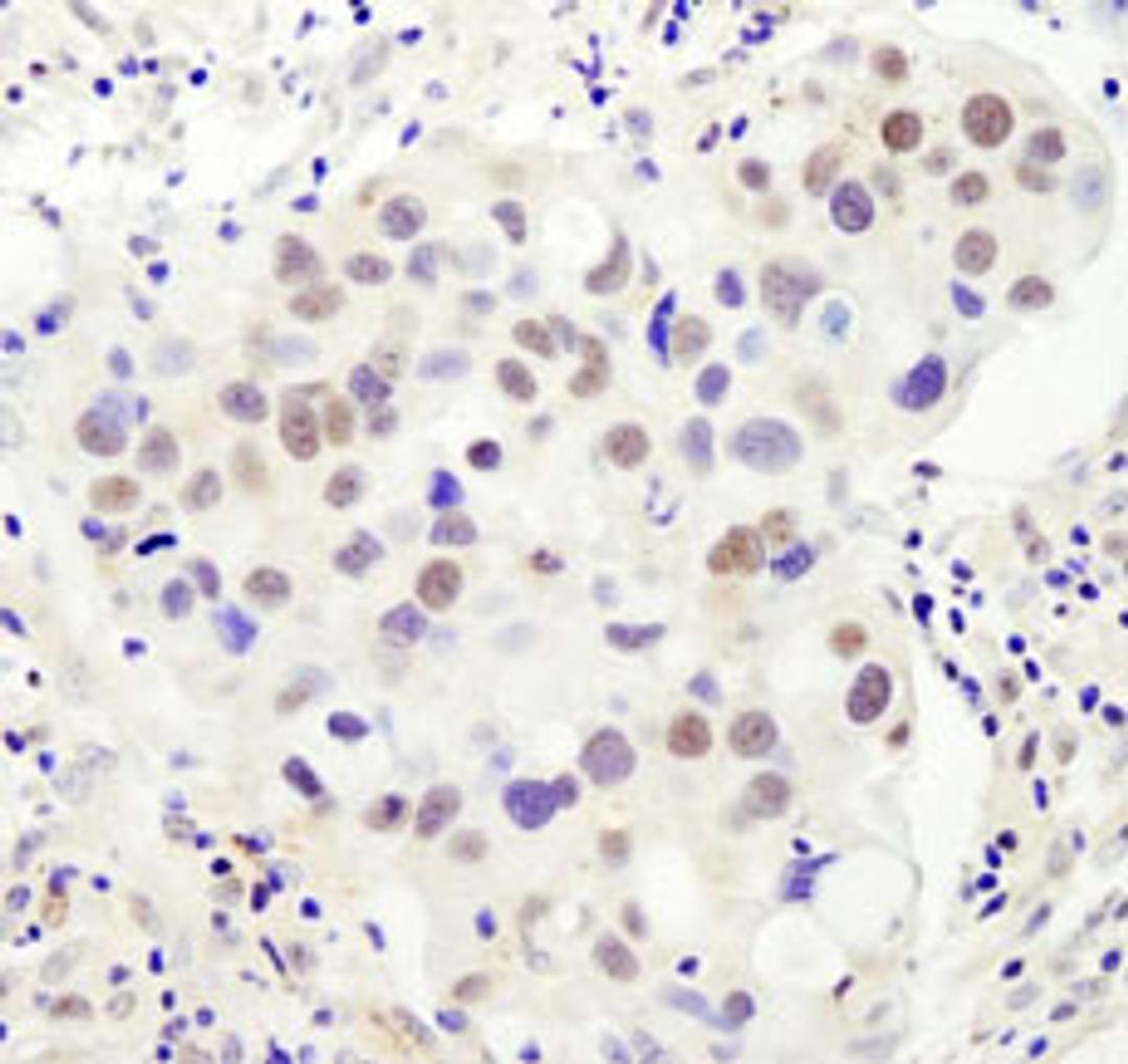 Detection of human PHF6 by immunohistochemistry.