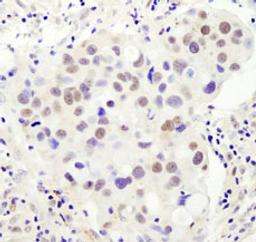 Detection of human PHF6 by immunohistochemistry.