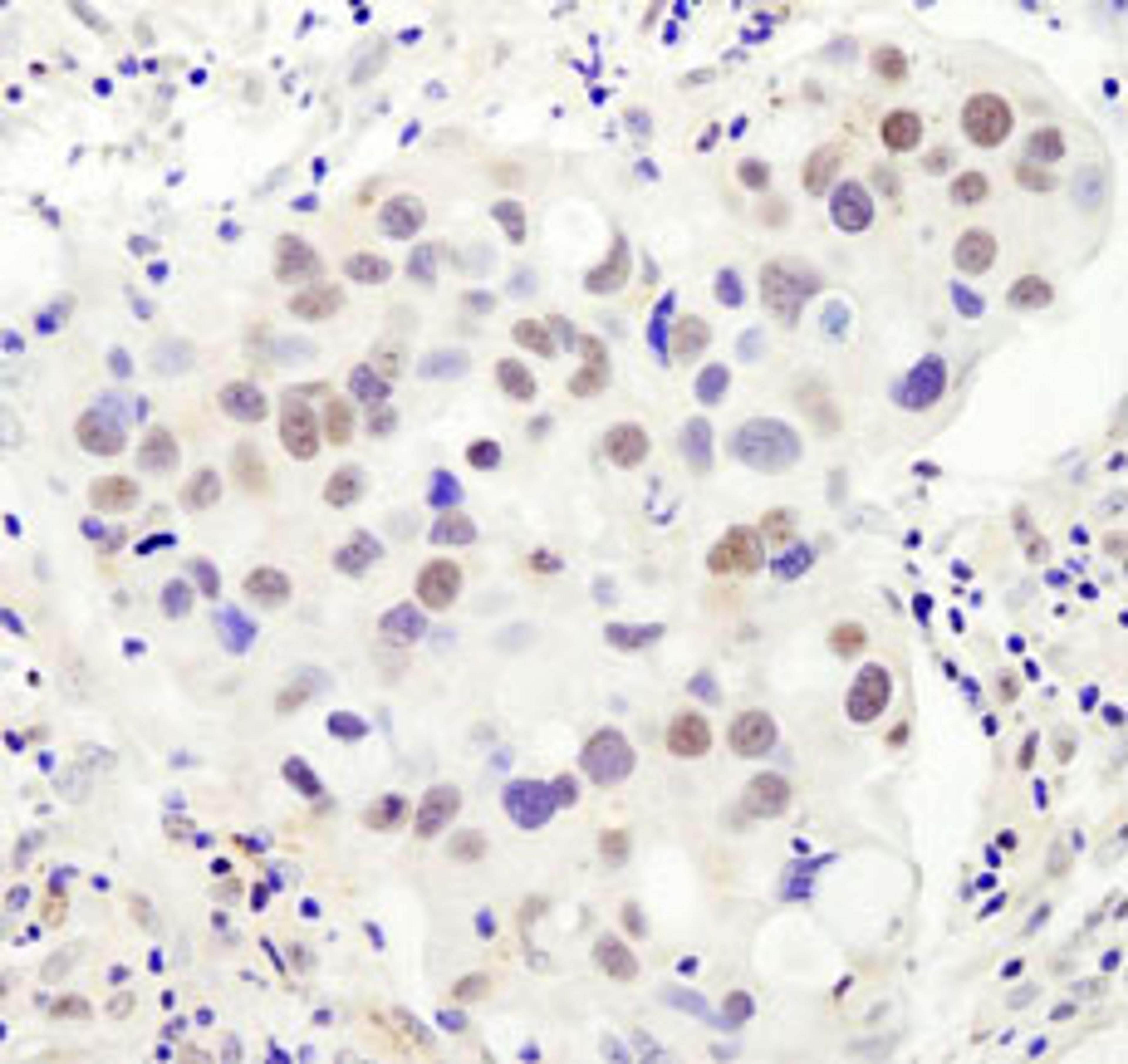 Detection of human PHF6 by immunohistochemistry.