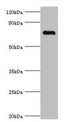Western blot. All lanes: Cartilage oligomeric matrix protein antibody at 4ug/ml + Mouse skeletal muscle tissue. Secondary. Goat polyclonal to rabbit IgG at 1/10000 dilution. Predicted band size: 83, 78 kDa. Observed band size: 83 kDa.