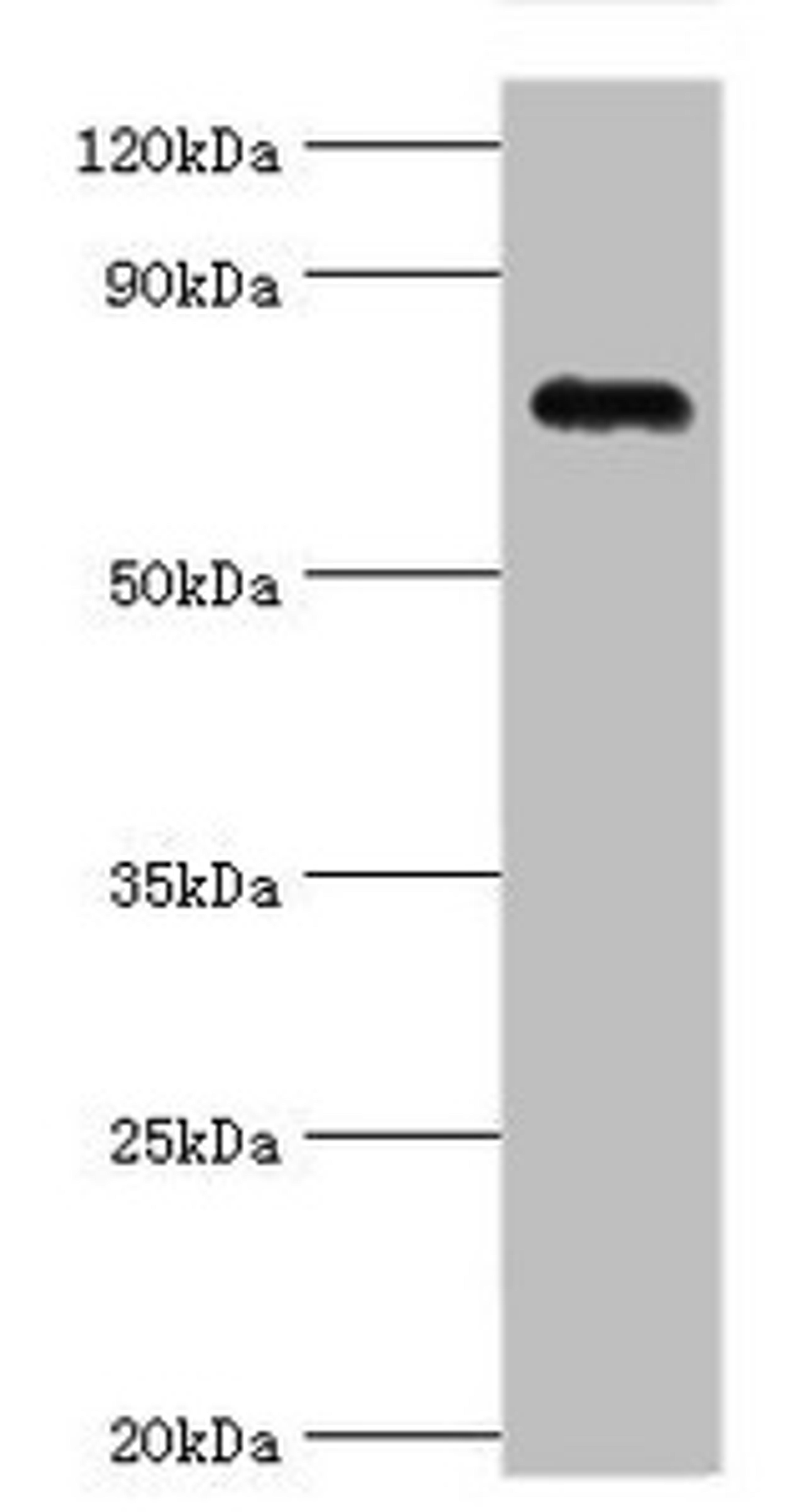 Western blot. All lanes: Cartilage oligomeric matrix protein antibody at 4ug/ml + Mouse skeletal muscle tissue. Secondary. Goat polyclonal to rabbit IgG at 1/10000 dilution. Predicted band size: 83, 78 kDa. Observed band size: 83 kDa.