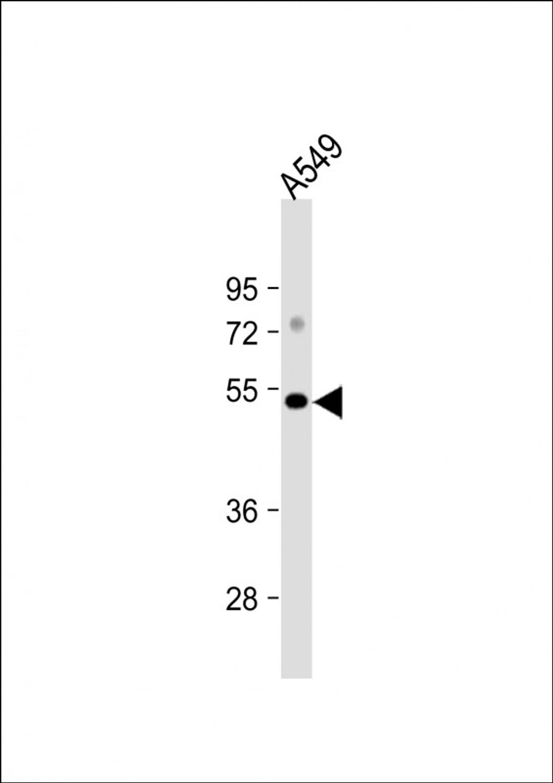 Western Blot at 1:1000 dilution + A549 whole cell lysate Lysates/proteins at 20 ug per lane.