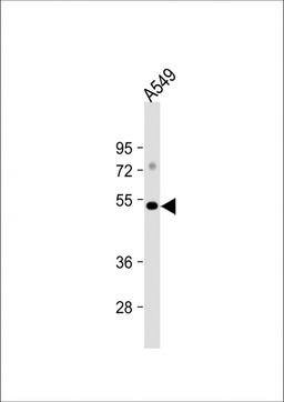 Western Blot at 1:1000 dilution + A549 whole cell lysate Lysates/proteins at 20 ug per lane.