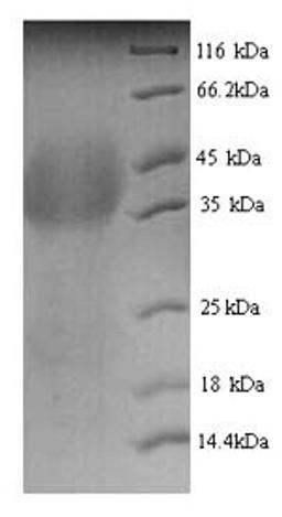 (Tris-Glycine gel) Discontinuous SDS-PAGE (reduced) with 5% enrichment gel and 15% separation gel.