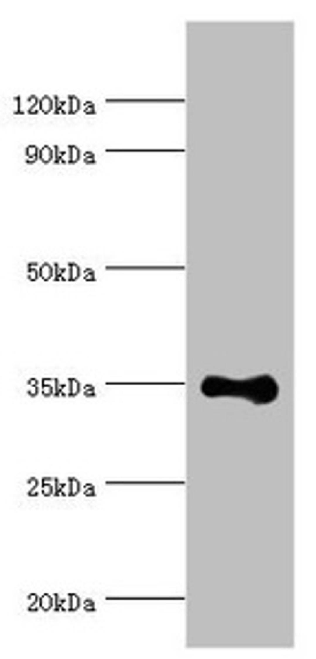 Western blot. All lanes: DNA repair protein RAD51 homolog 4 antibody at 8ug/ml + Jurkat whole cell lysate. Secondary. Goat polyclonal to rabbit IgG at 1/10000 dilution. Predicted band size: 36, 6, 24, 31, 13, 23, 38 kDa. Observed band size: 36 kDa. 