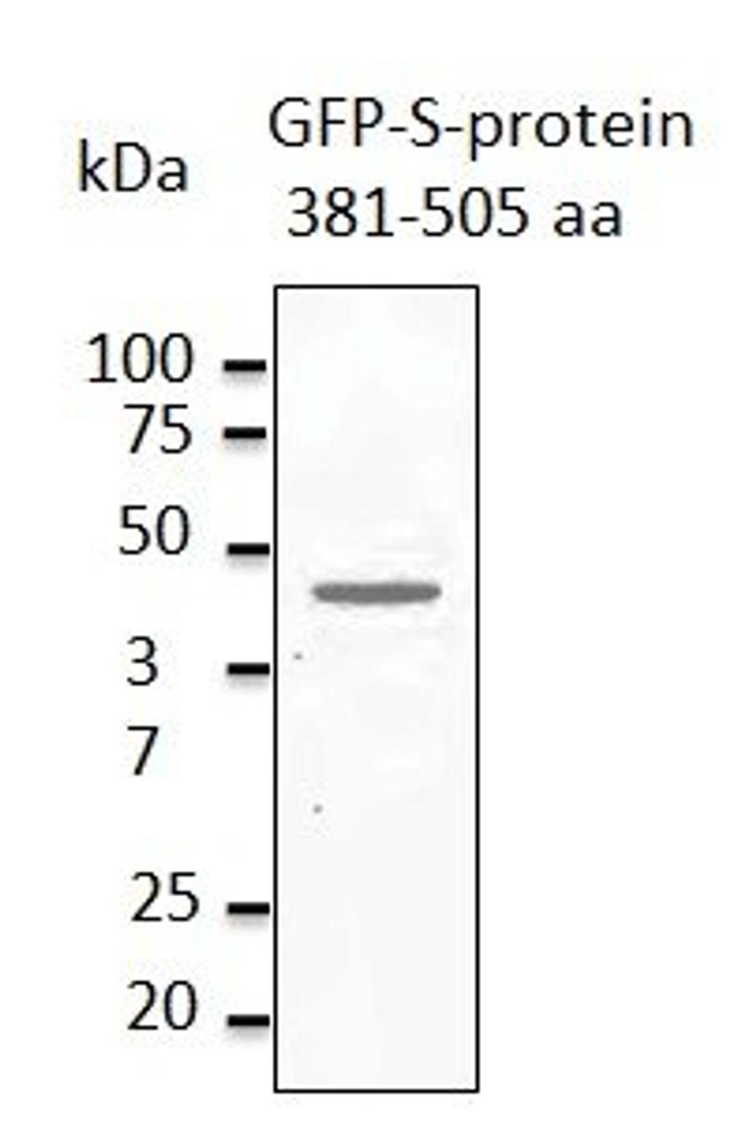 Western blot analysis of staining of HEK293 transfected cell lysates using MERSC-CoV Spike Protein antibody