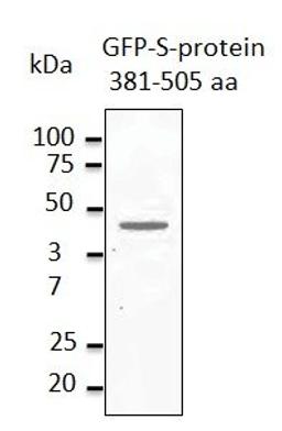 Western blot analysis of staining of HEK293 transfected cell lysates using MERSC-CoV Spike Protein antibody