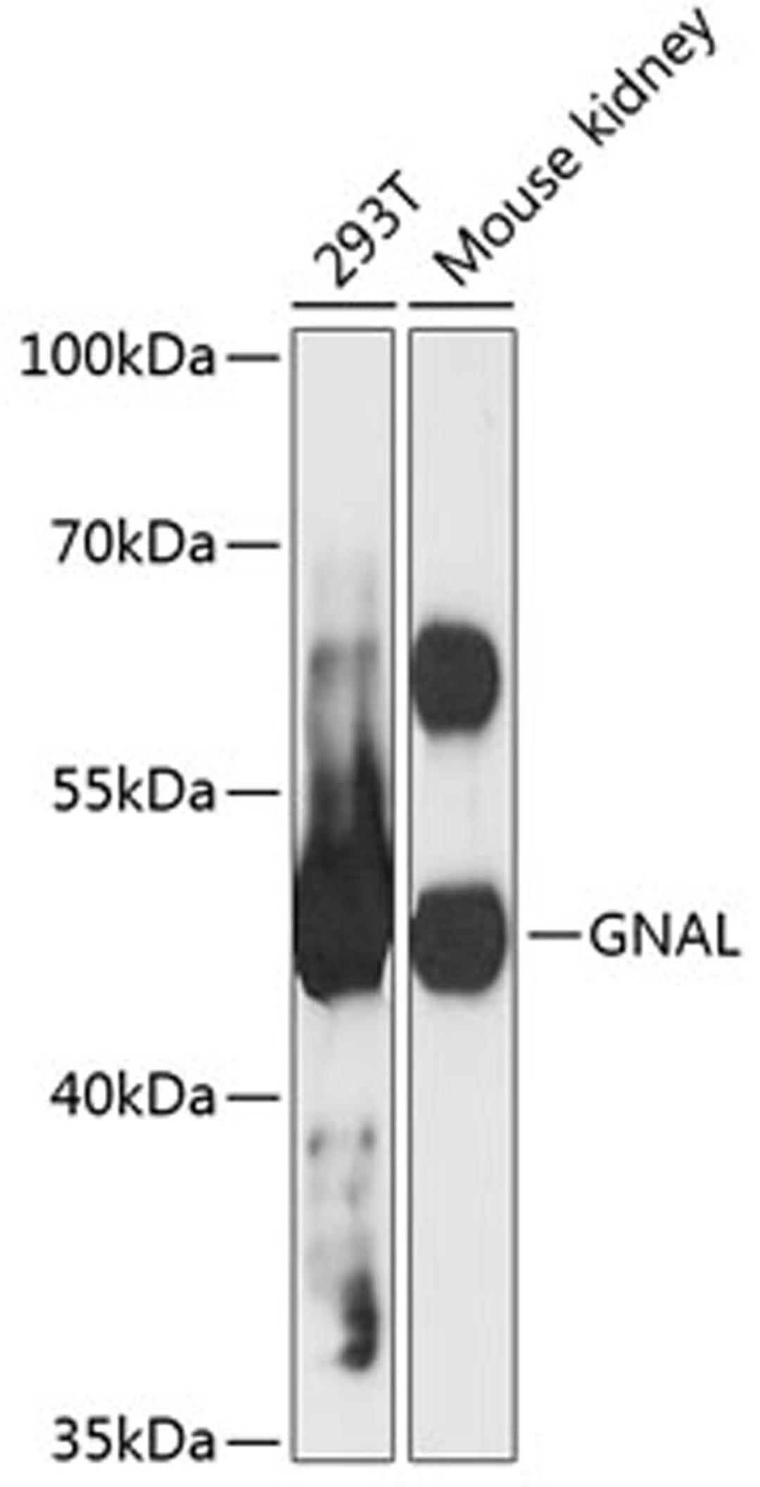 Western blot - GNAL antibody (A12804)