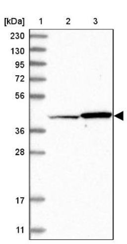 Western Blot: OSGEPL1 Antibody [NBP1-85928] - Lane 1: Marker [kDa] 230, 130, 95, 72, 56, 36, 28, 17, 11<br/>Lane 2: Human cell line RT-4<br/>Lane 3: Human cell line U-251MG sp