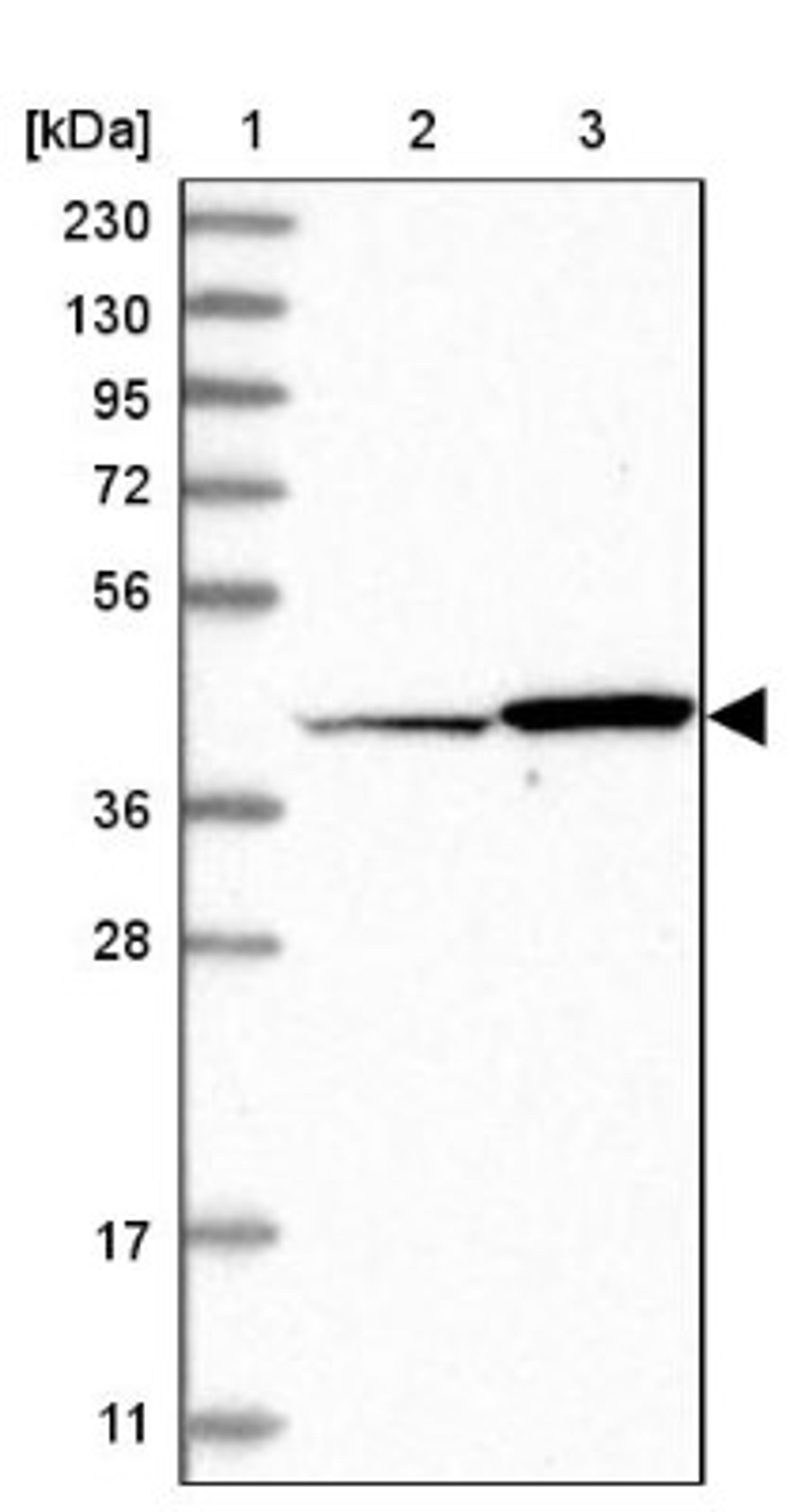 Western Blot: OSGEPL1 Antibody [NBP1-85928] - Lane 1: Marker [kDa] 230, 130, 95, 72, 56, 36, 28, 17, 11<br/>Lane 2: Human cell line RT-4<br/>Lane 3: Human cell line U-251MG sp