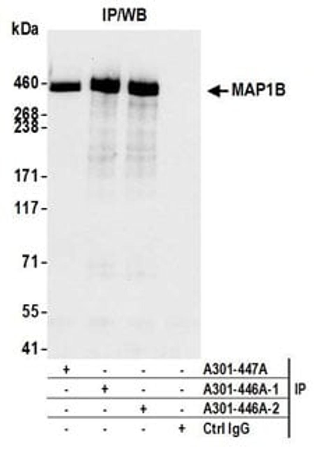 Detection of human MAP1B by western blot of immunoprecipitates.