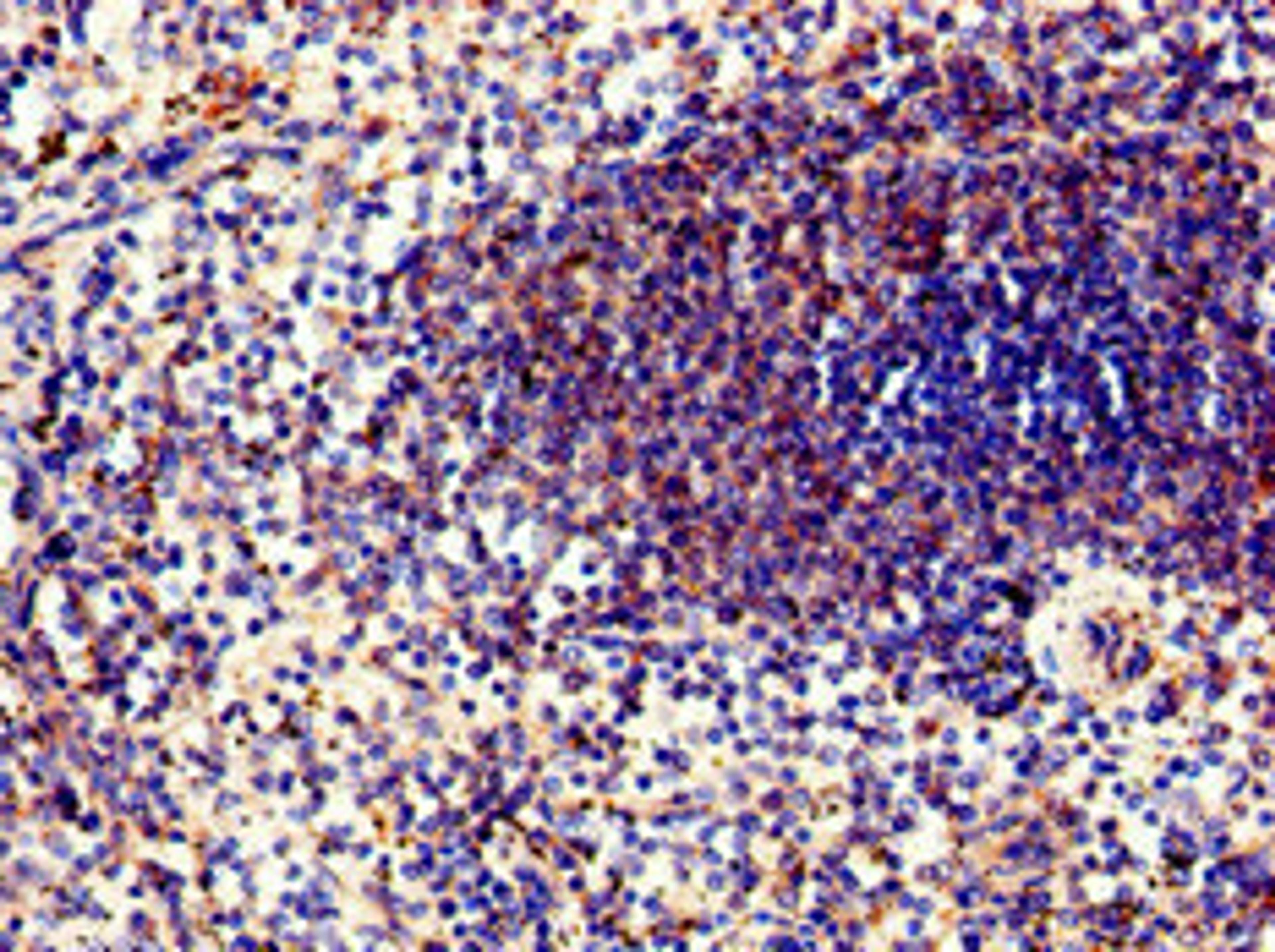 Immunohistochemistry of paraffin-embedded human spleen tissue using CSB-PA018583LA01HU at dilution of 1:100