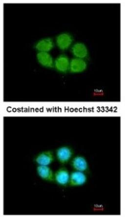 Immunocytochemistry/Immunofluorescence: Kanadaptin Antibody [NBP2-17014] - Analysis of methanol-fixed A431, using antibody at 1:200 dilution.