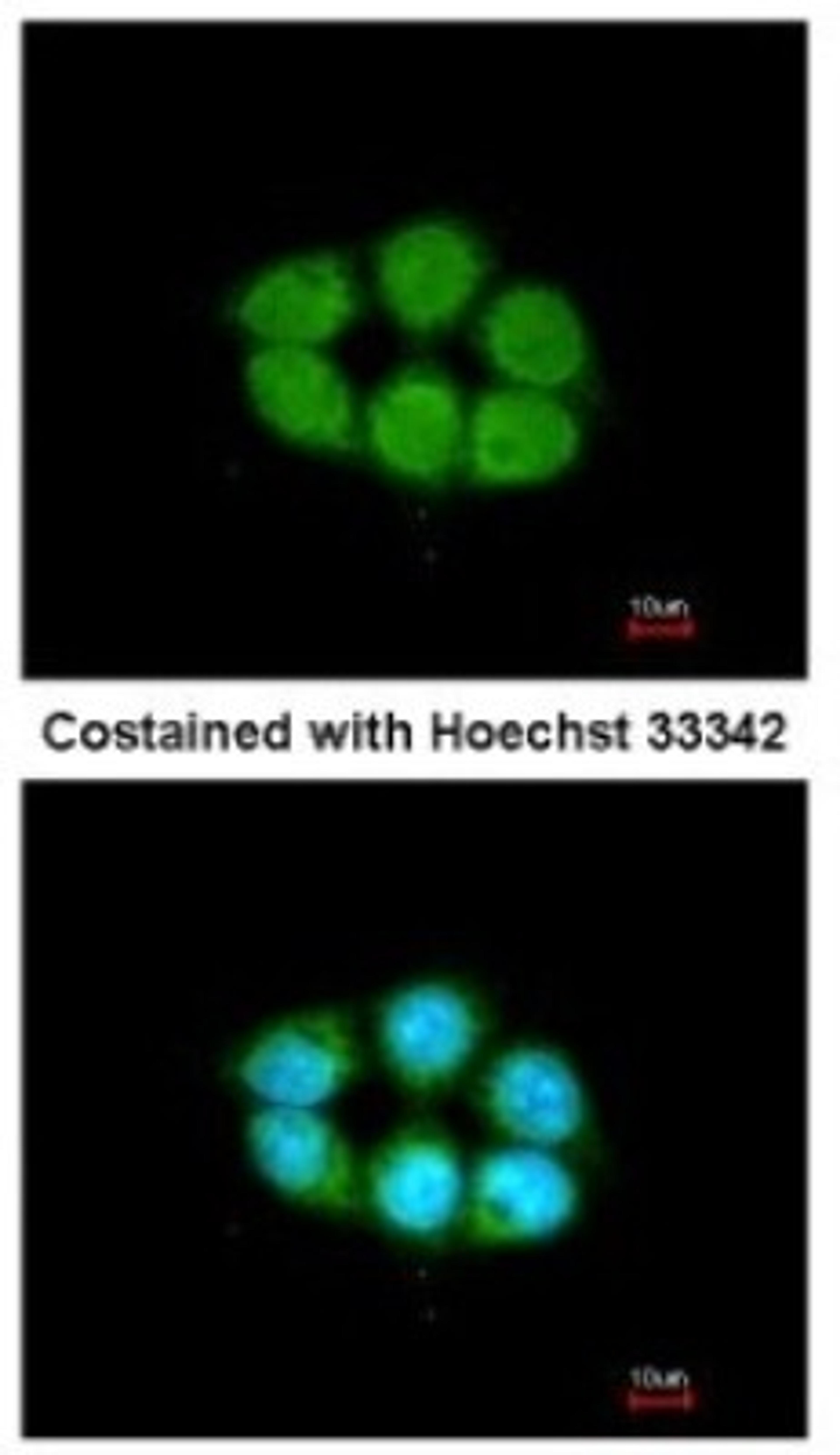 Immunocytochemistry/Immunofluorescence: Kanadaptin Antibody [NBP2-17014] - Analysis of methanol-fixed A431, using antibody at 1:200 dilution.