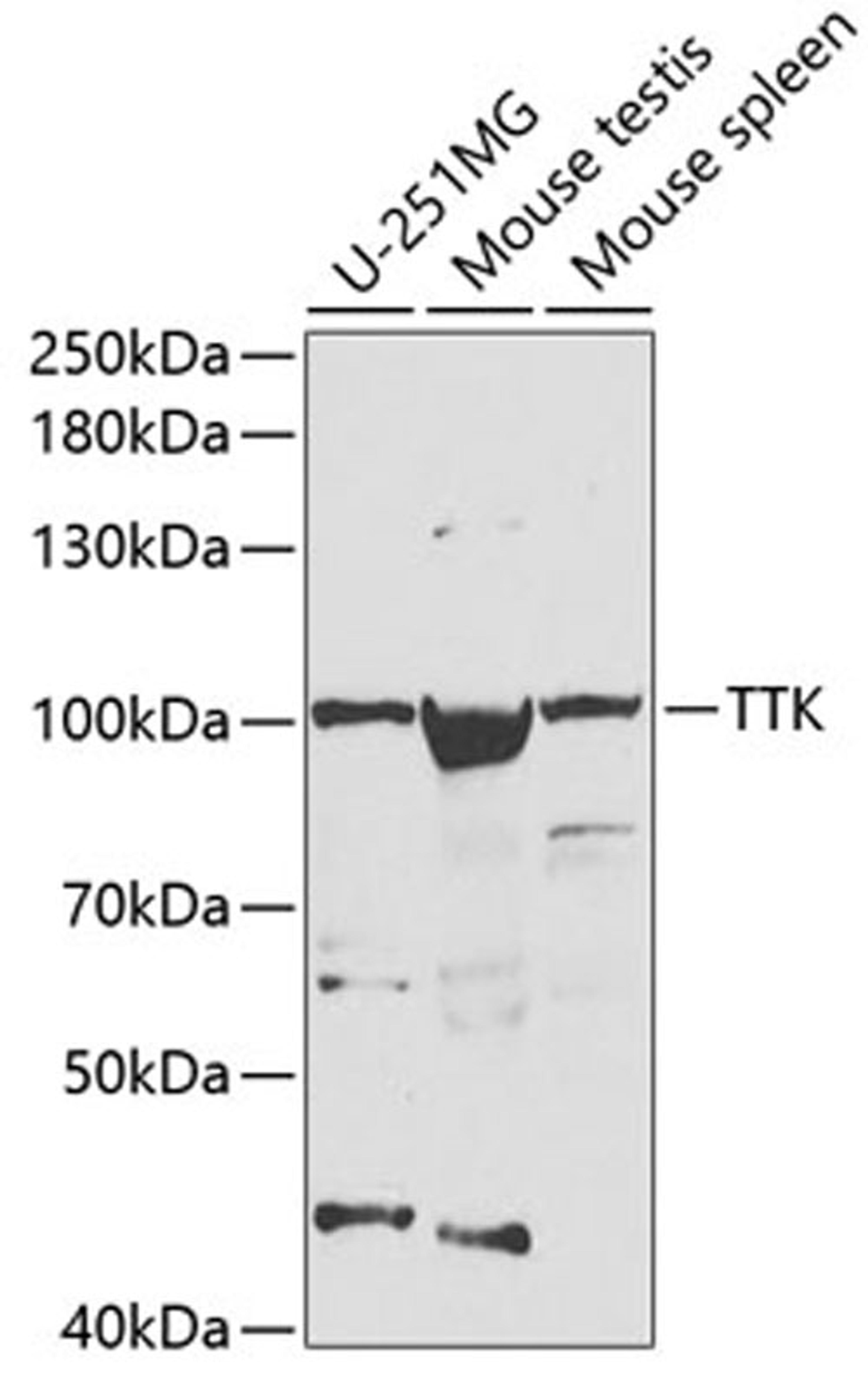 Western blot - TTK antibody (A2500)