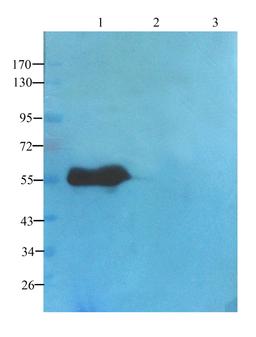 WB analysis of human lung cancer (lane 1); Hela cells (lane 2); 293T cells (lane 3) using TGF beta Receptor 2 antibody (1 ug/ml)
