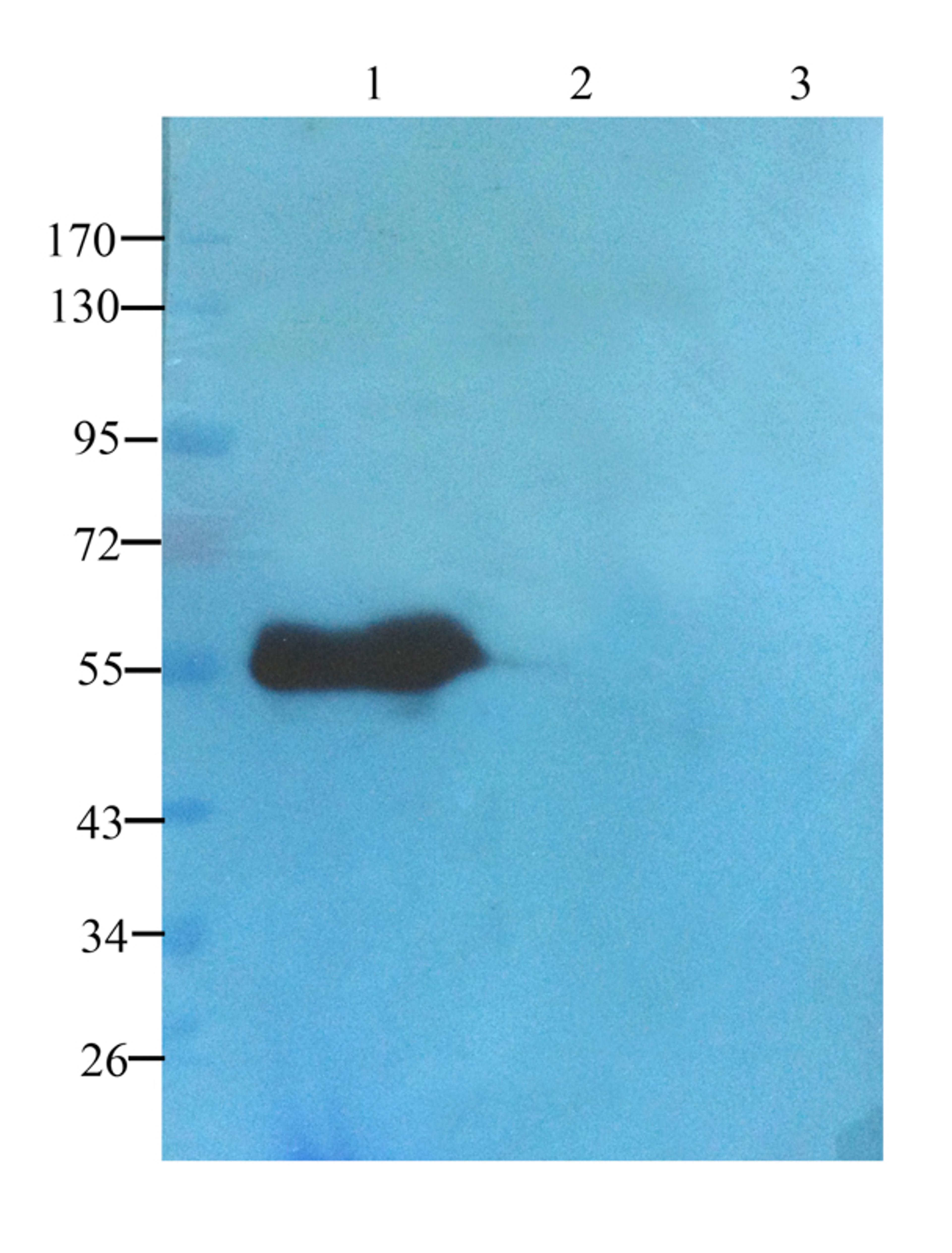WB analysis of human lung cancer (lane 1); Hela cells (lane 2); 293T cells (lane 3) using TGF beta Receptor 2 antibody (1 ug/ml)