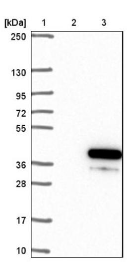 Western Blot: C20orf111 Antibody [NBP1-91725] - Lane 1: Marker [kDa] 250, 130, 95, 72, 55, 36, 28, 17, 10<br/>Lane 2: Negative control (vector only transfected HEK293T lysate)<br/>Lane 3: Over-expression lysate (Co-expressed with a C-terminal myc-DDK tag (~3.1 kDa) in mammalian HEK293T cells, LY413969)