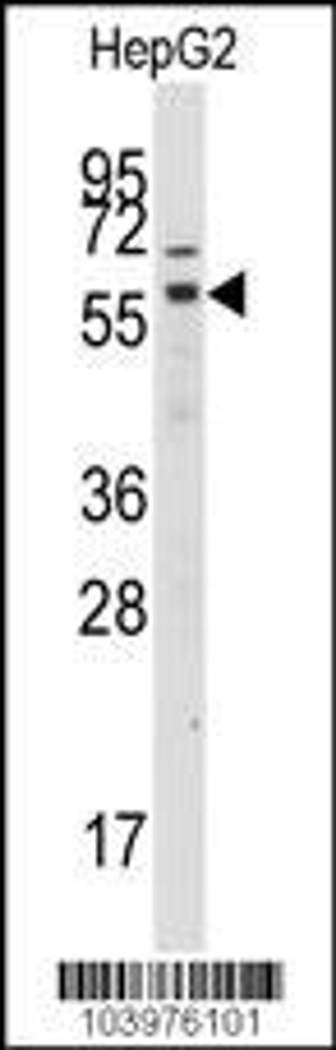 Western blot analysis of anti-GRK7 Antibody in HepG2 cell line lysates (35ug/lane)