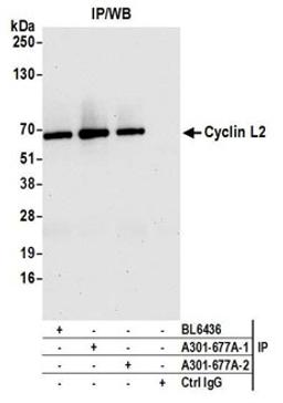 Detection of human Cyclin L2 by western blot of immunoprecipitates.