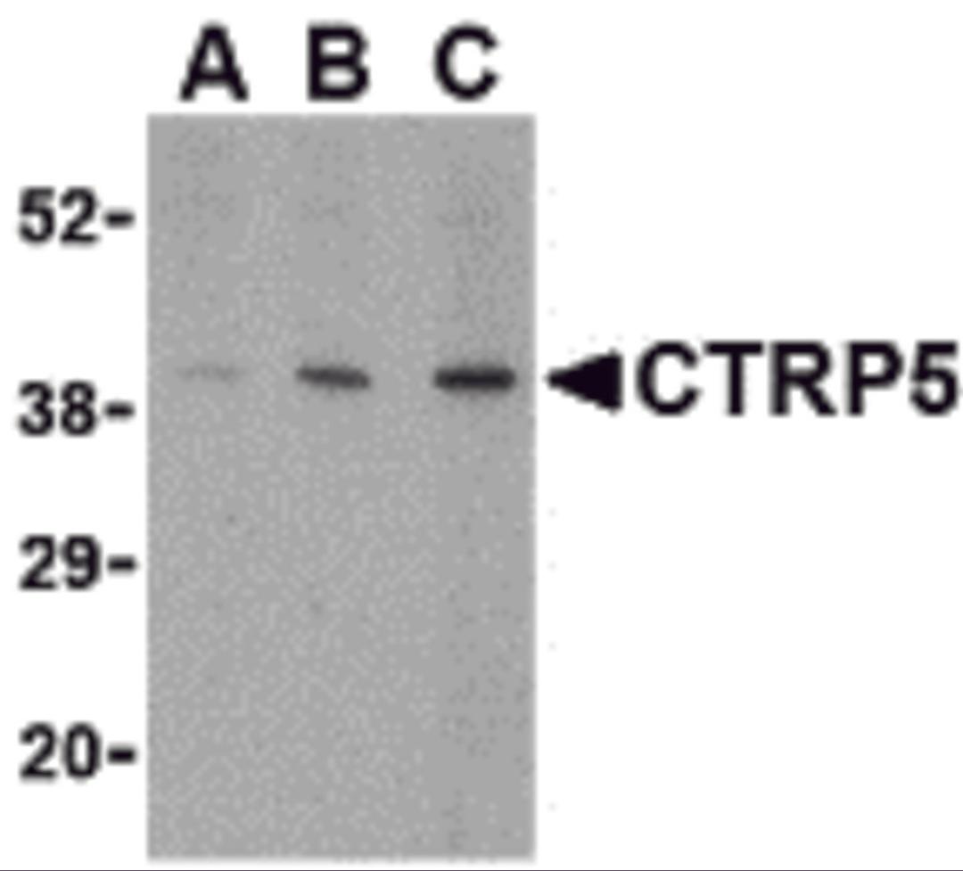 Western blot analysis of CTRP5 in caco-2 cell lysate with CTRP5 antibody at (A) 1, (B) 2, and (C) 4 &#956;g/mL.