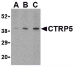 Western blot analysis of CTRP5 in caco-2 cell lysate with CTRP5 antibody at (A) 1, (B) 2, and (C) 4 &#956;g/mL.