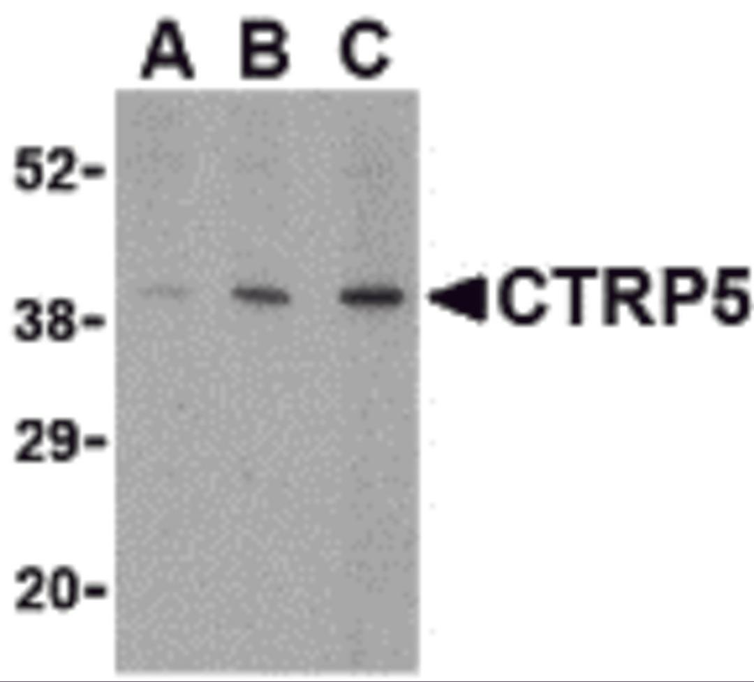 Western blot analysis of CTRP5 in caco-2 cell lysate with CTRP5 antibody at (A) 1, (B) 2, and (C) 4 μg/mL.
