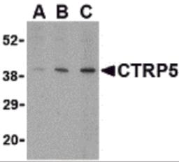 Western blot analysis of CTRP5 in caco-2 cell lysate with CTRP5 antibody at (A) 1, (B) 2, and (C) 4 μg/mL.