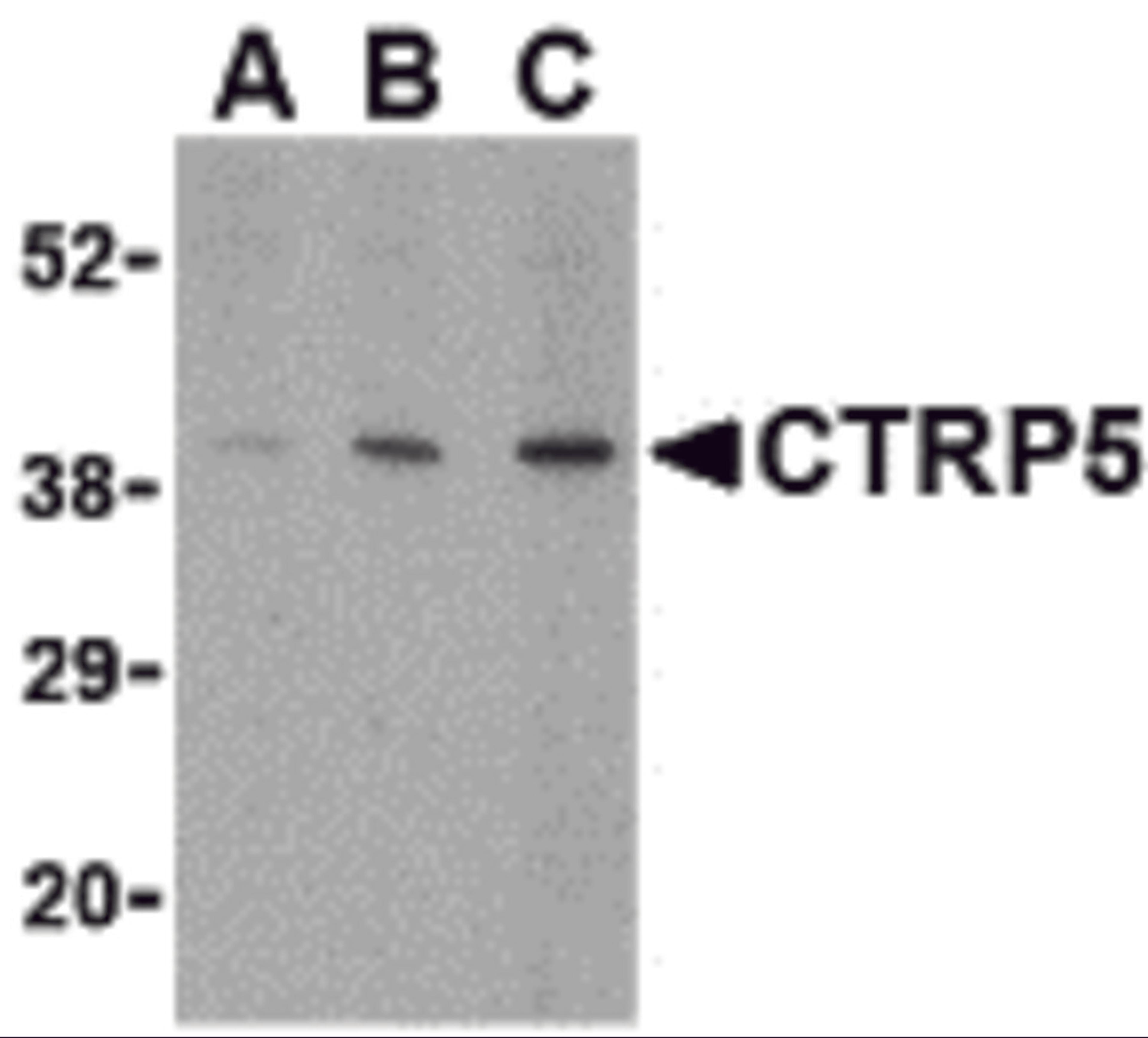 Western blot analysis of CTRP5 in caco-2 cell lysate with CTRP5 antibody at (A) 1, (B) 2, and (C) 4 μg/mL.
