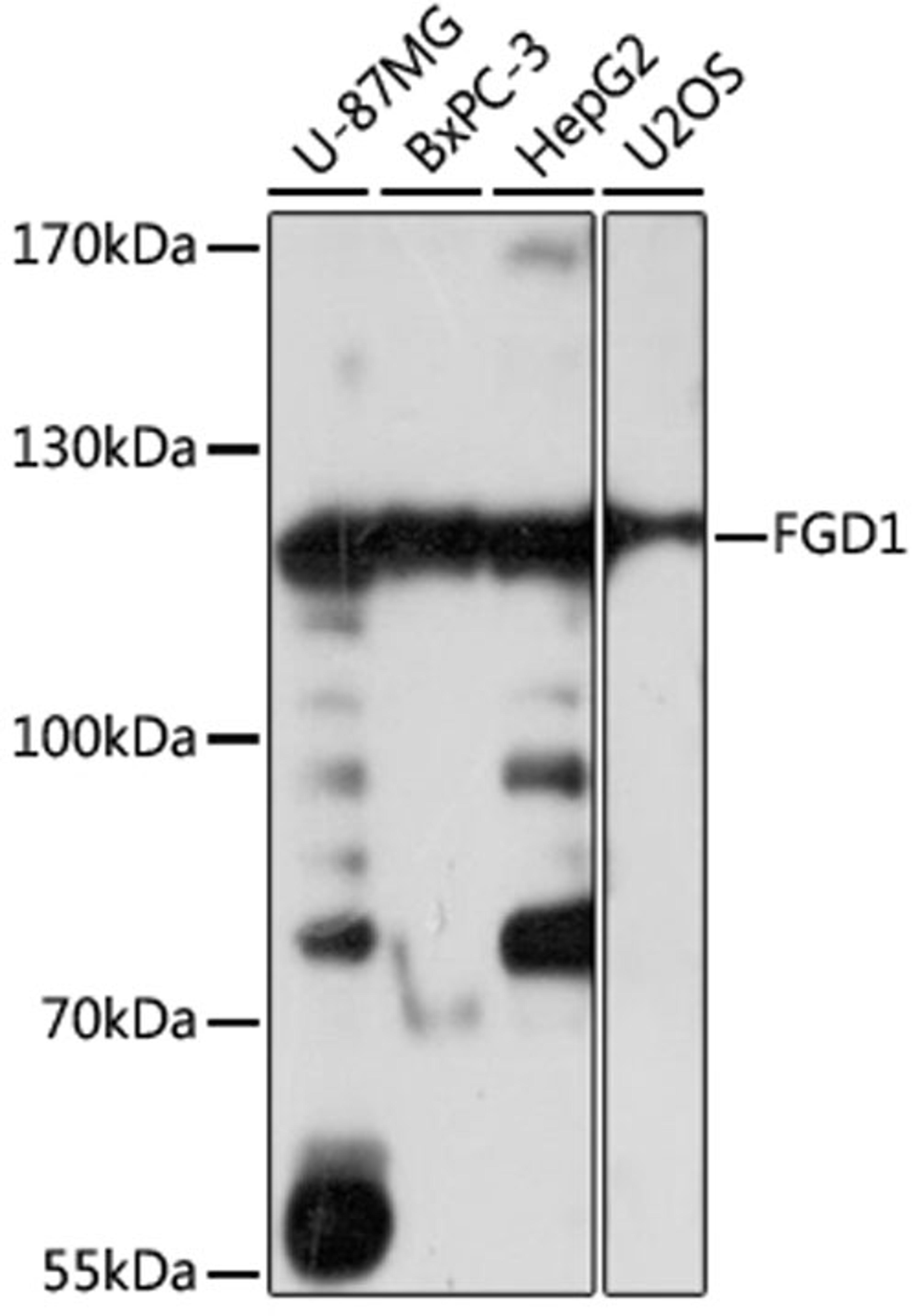 Western blot - FGD1 antibody (A16374)