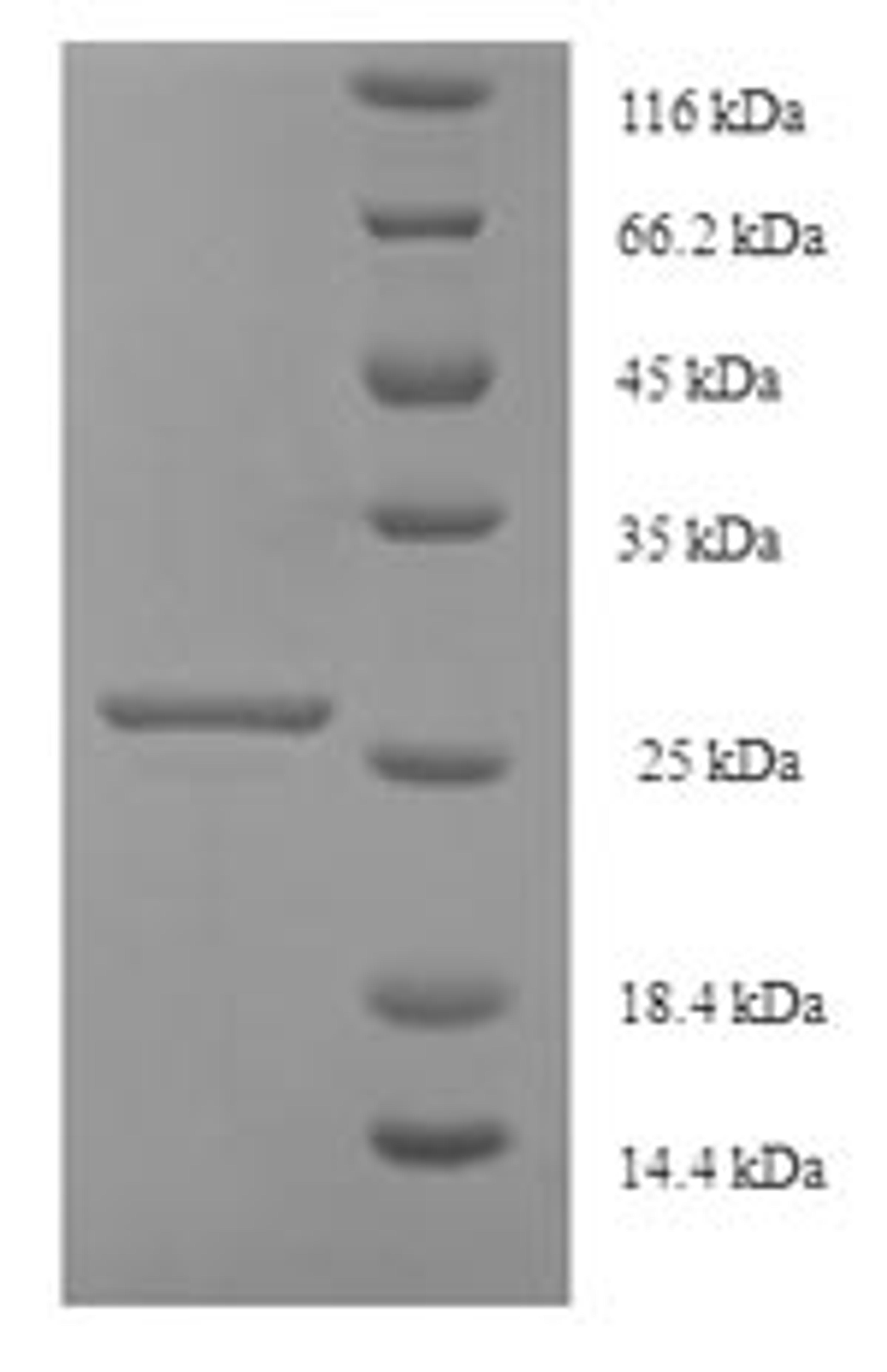(Tris-Glycine gel) Discontinuous SDS-PAGE (reduced) with 5% enrichment gel and 15% separation gel.