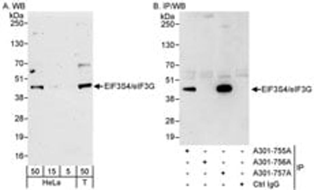 Detection of human eIF3G/EIF3S4 by western blot and immunoprecipitation.