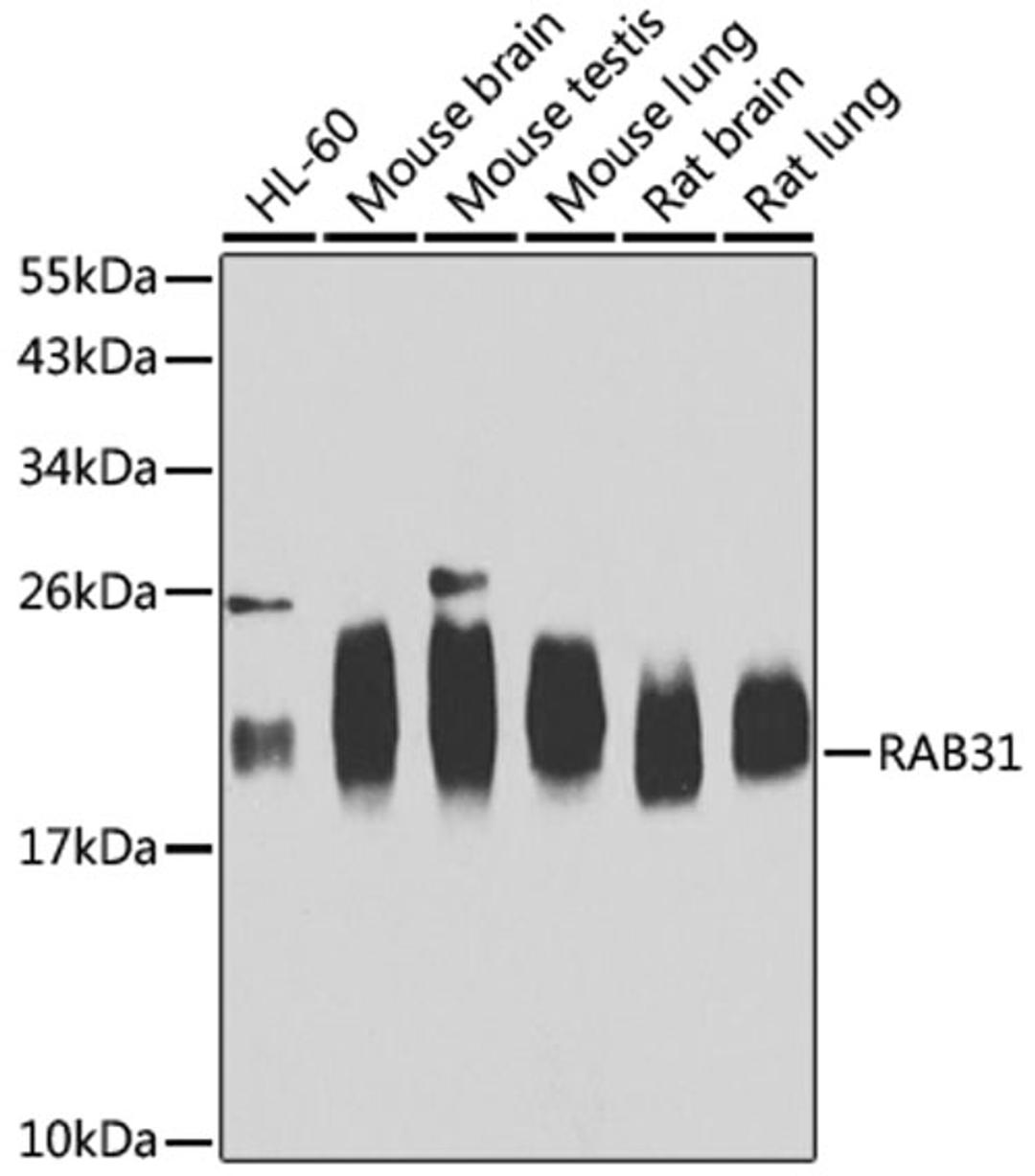 Western blot - RAB31 antibody (A7506)