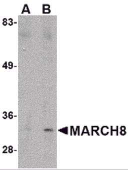 Western blot analysis of MARCH8 in HeLa cell lysate with MARCH8 antibody at (A) 0.5 &#956;g/ml and (B) 1 &#956;g/mL.