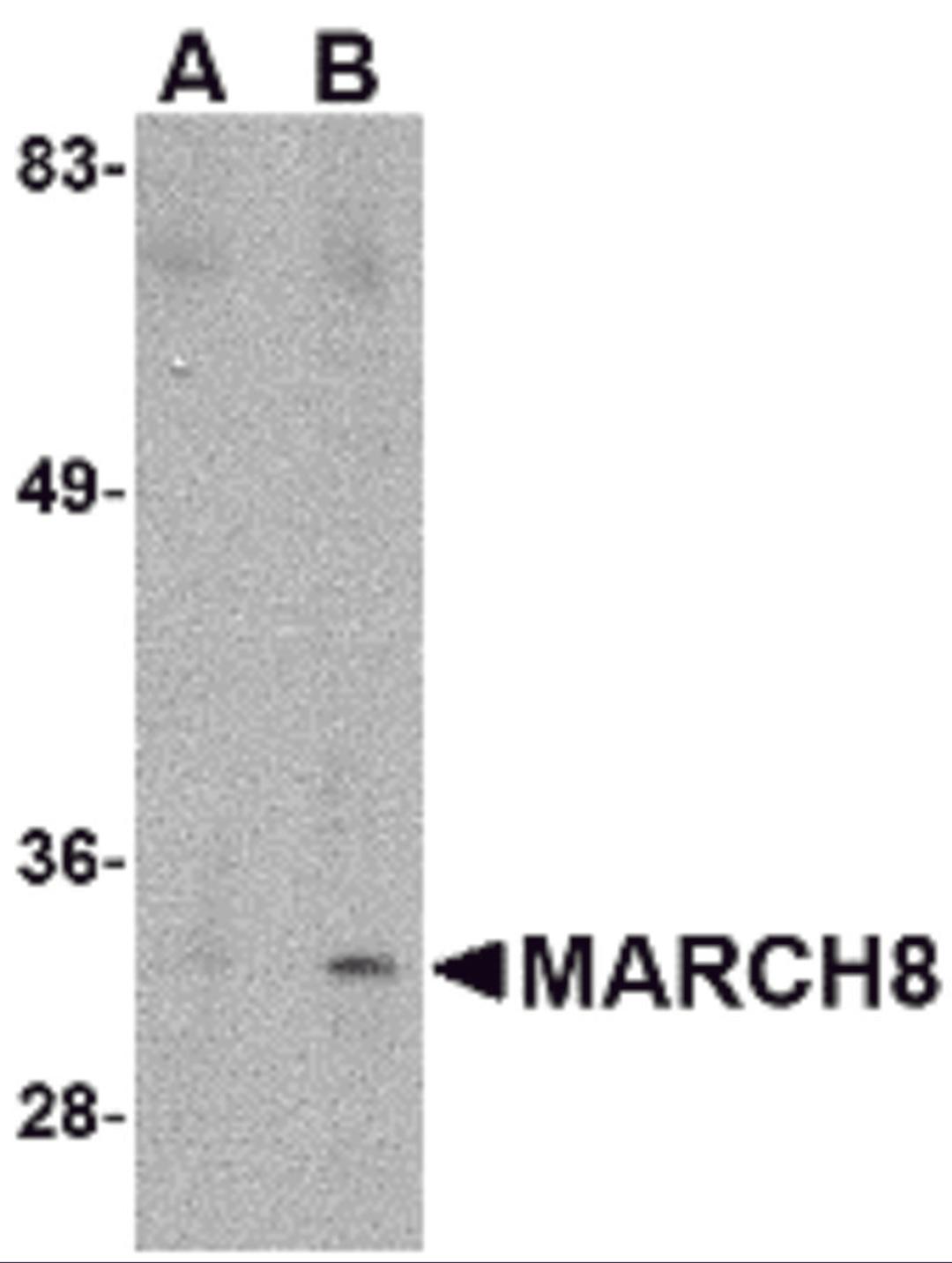 Western blot analysis of MARCH8 in HeLa cell lysate with MARCH8 antibody at (A) 0.5 μg/ml and (B) 1 μg/mL.