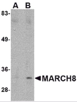 Western blot analysis of MARCH8 in HeLa cell lysate with MARCH8 antibody at (A) 0.5 μg/ml and (B) 1 μg/mL.