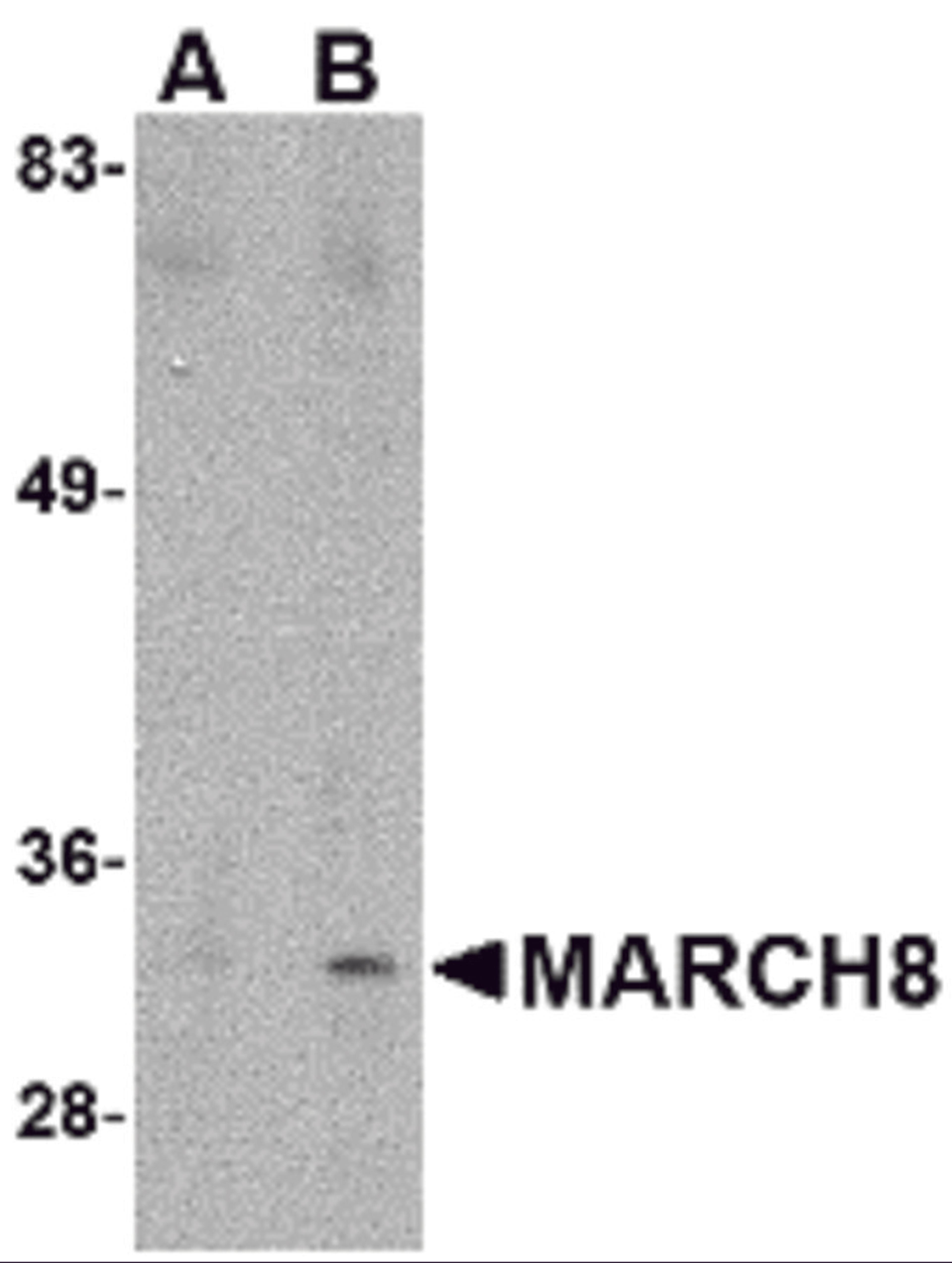 Western blot analysis of MARCH8 in HeLa cell lysate with MARCH8 antibody at (A) 0.5 μg/ml and (B) 1 μg/mL.