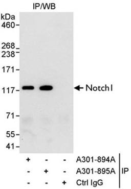 Detection of human Notch1 by western blot of immunoprecipitates.