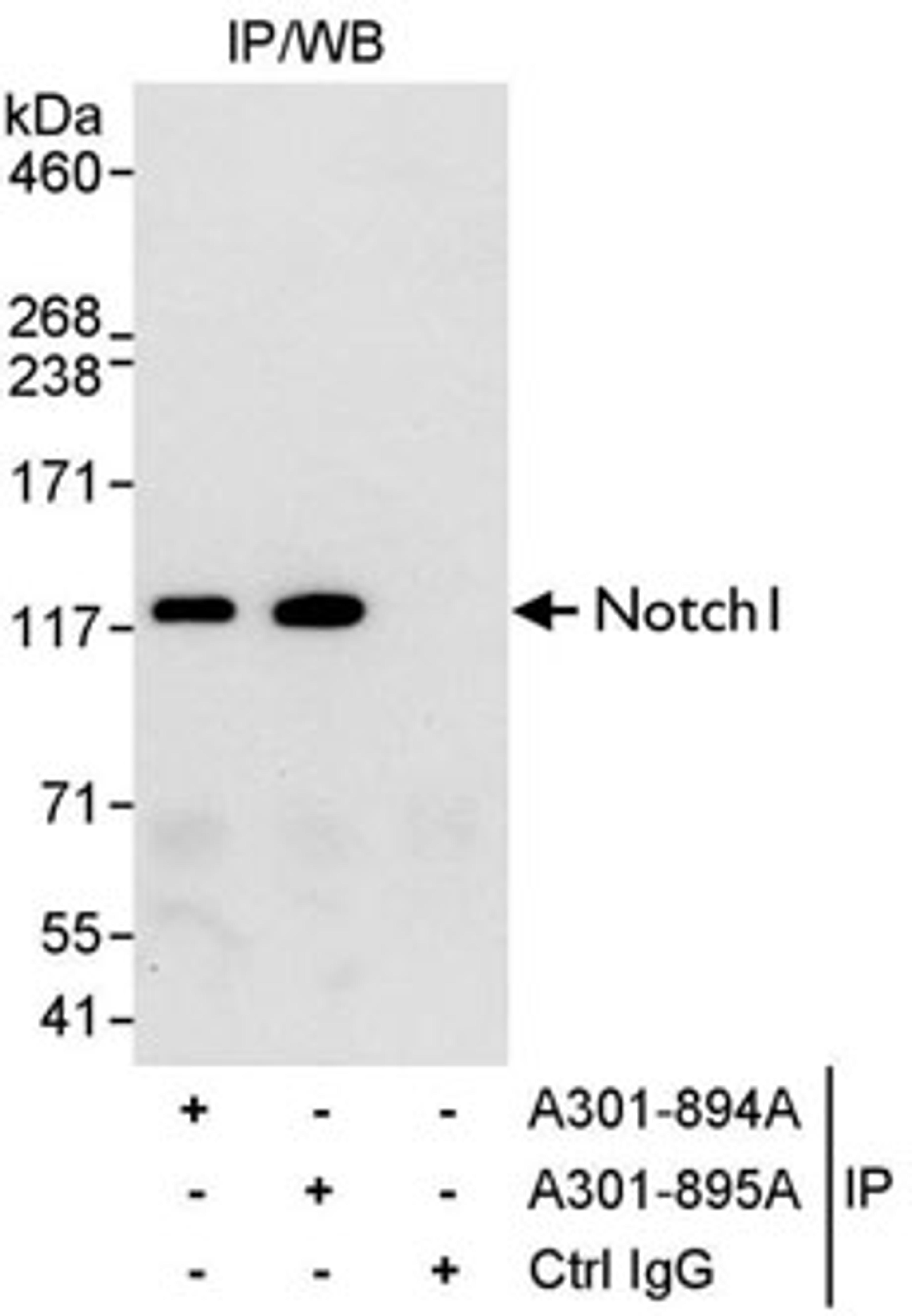 Detection of human Notch1 by western blot of immunoprecipitates.