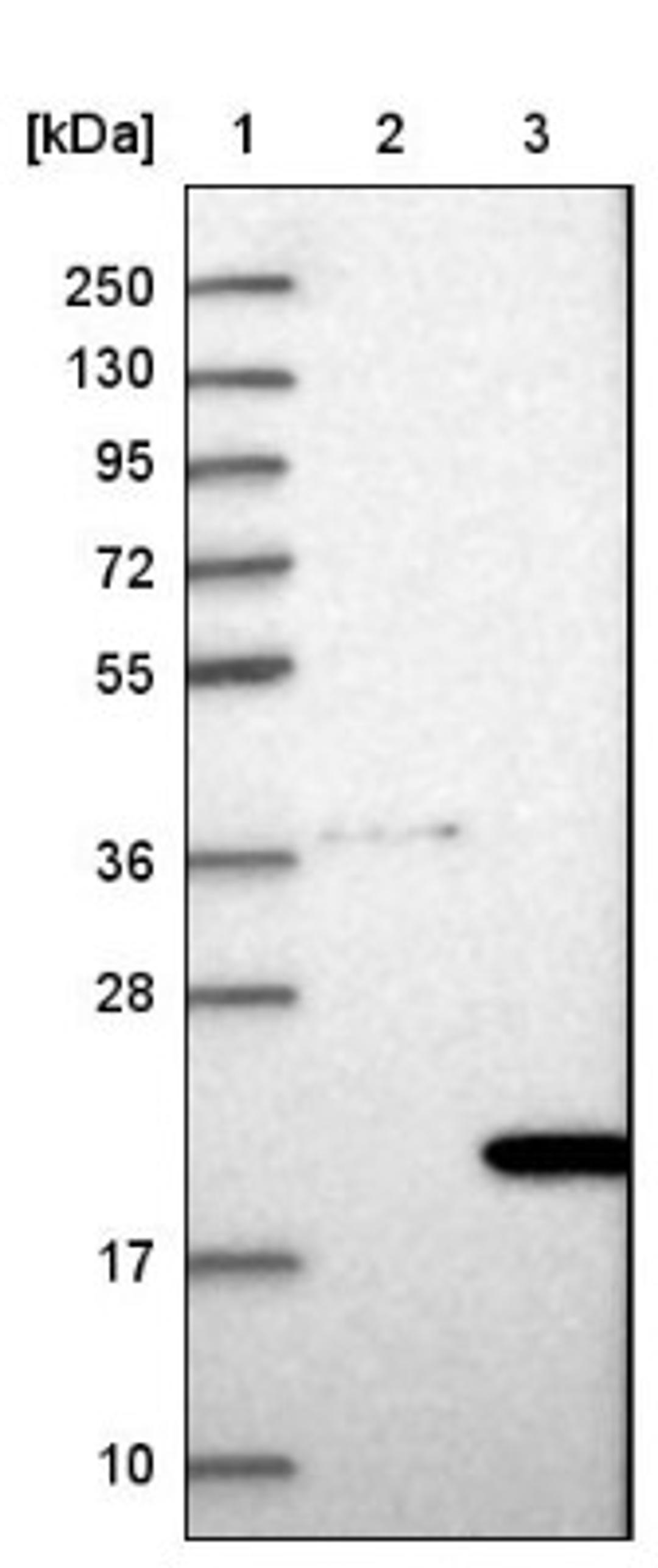 Western Blot: COMMD8 Antibody [NBP1-82178] - Lane 1: Marker [kDa] 250, 130, 95, 72, 55, 36, 28, 17, 10<br/>Lane 2: Negative control (vector only transfected HEK293T lysate)<br/>Lane 3: Over-expression lysate (Co-expressed with a C-terminal myc-DDK tag (~3.1 kDa) in mammalian HEK293T cells, LY413465)