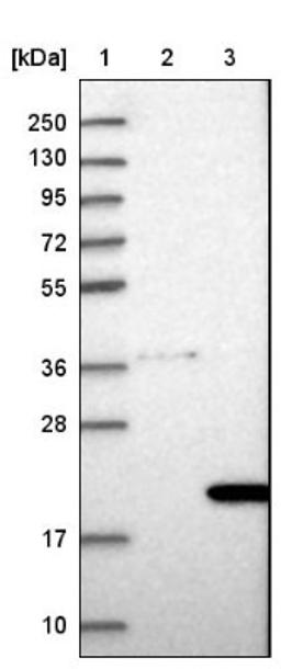 Western Blot: COMMD8 Antibody [NBP1-82178] - Lane 1: Marker [kDa] 250, 130, 95, 72, 55, 36, 28, 17, 10<br/>Lane 2: Negative control (vector only transfected HEK293T lysate)<br/>Lane 3: Over-expression lysate (Co-expressed with a C-terminal myc-DDK tag (~3.1 kDa) in mammalian HEK293T cells, LY413465)