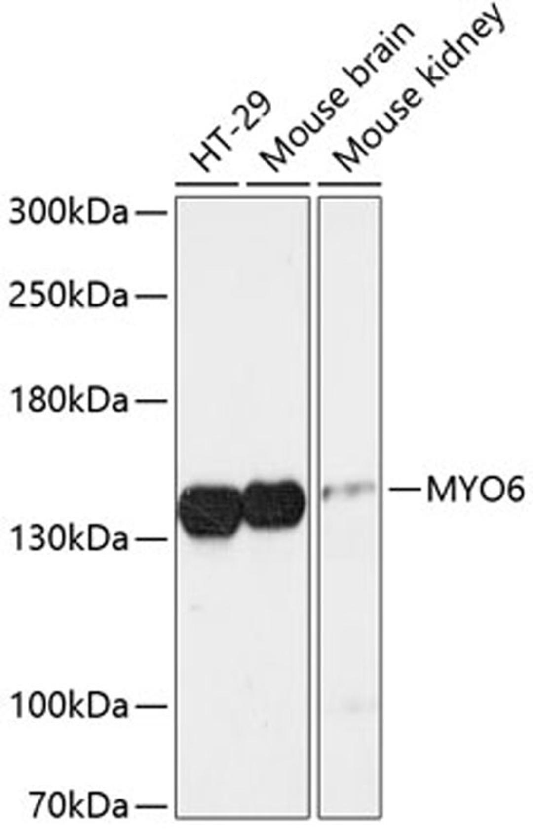 Western blot - MYO6 antibody (A13033)