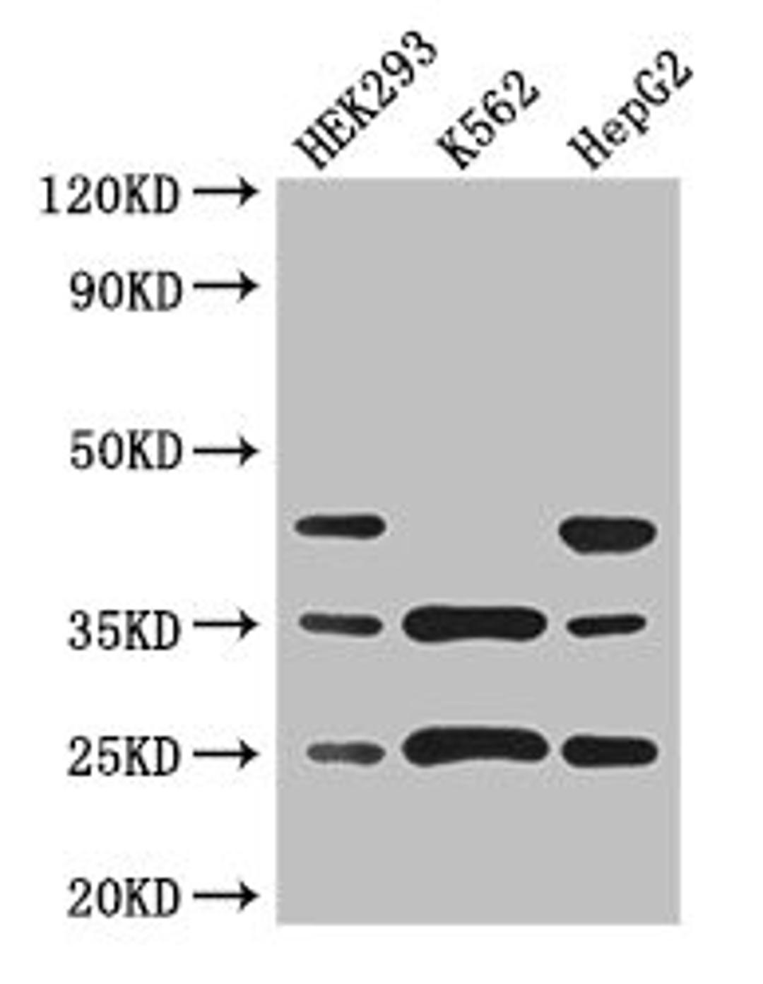 Western Blot. Positive WB detected in: HEK293 whole cell lysate, K562 whole cell lysate, HepG2 whole cell lysate. All lanes: PCTP antibody at 3ug/ml. Secondary. Goat polyclonal to rabbit IgG at 1/50000 dilution. Predicted band size: 25, 17 kDa. Observed band size: 25, 35, 45 kDa. 