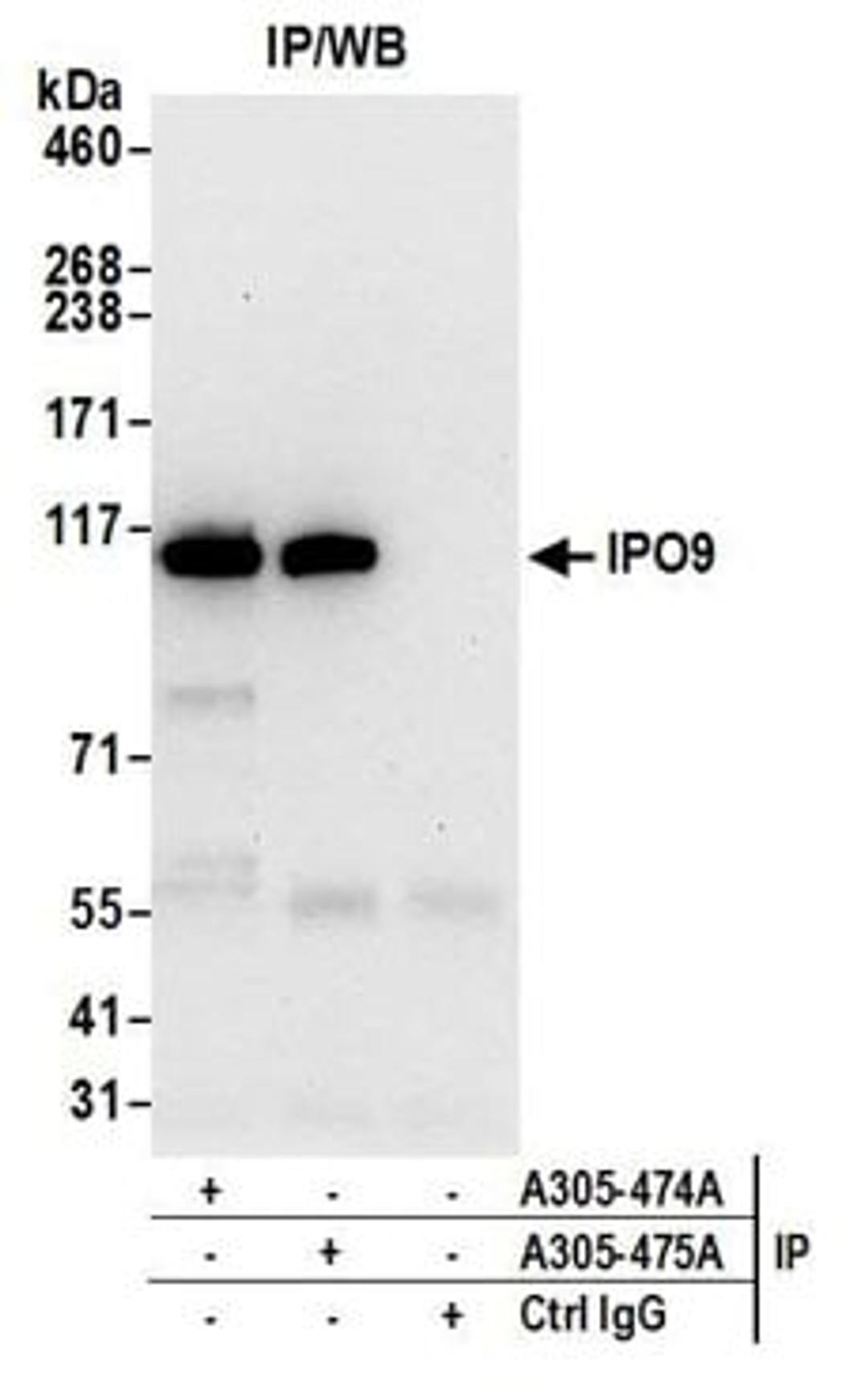 Detection of human IPO9 by western blot of immunoprecipitates.