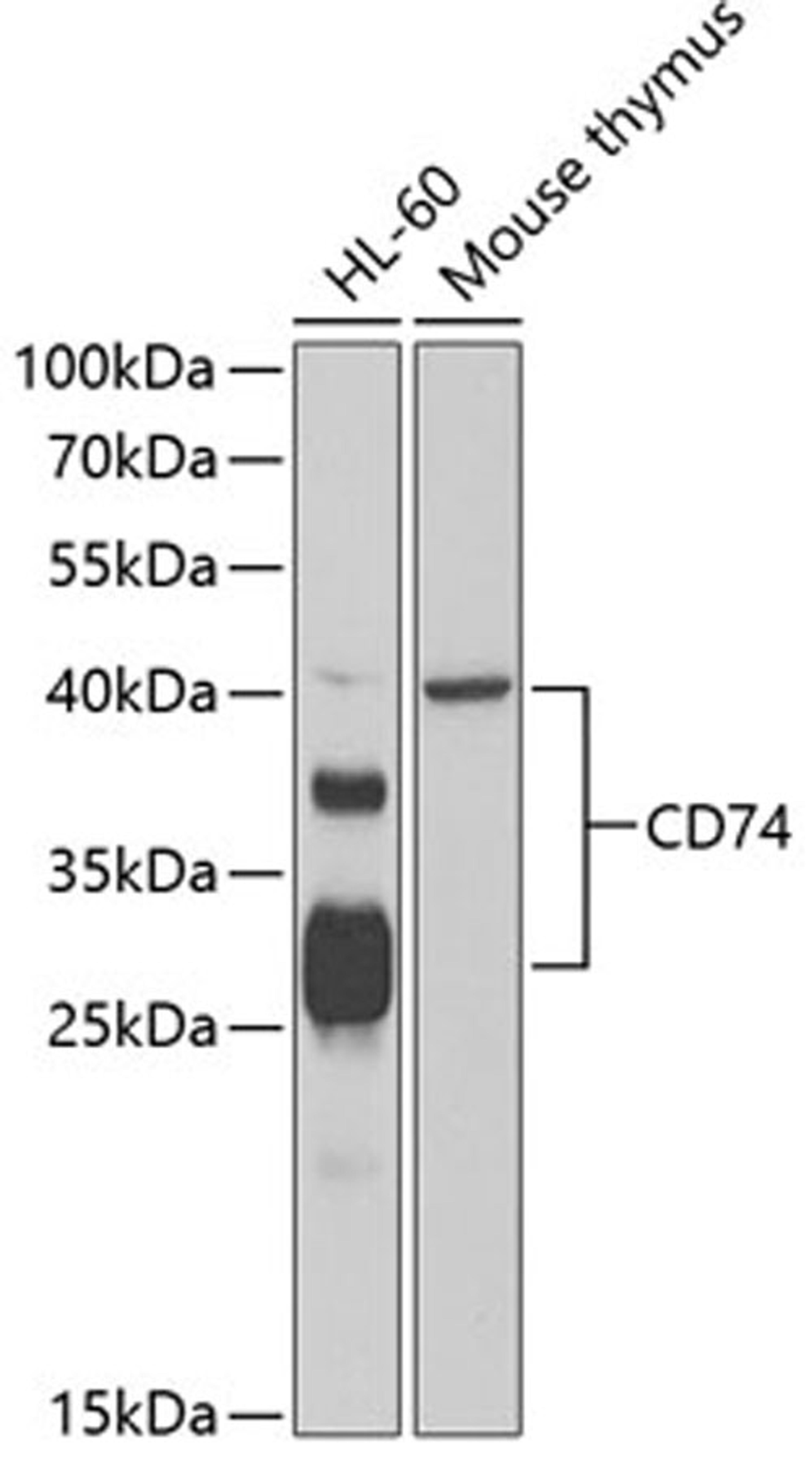 Western blot - CD74 antibody (A13958)