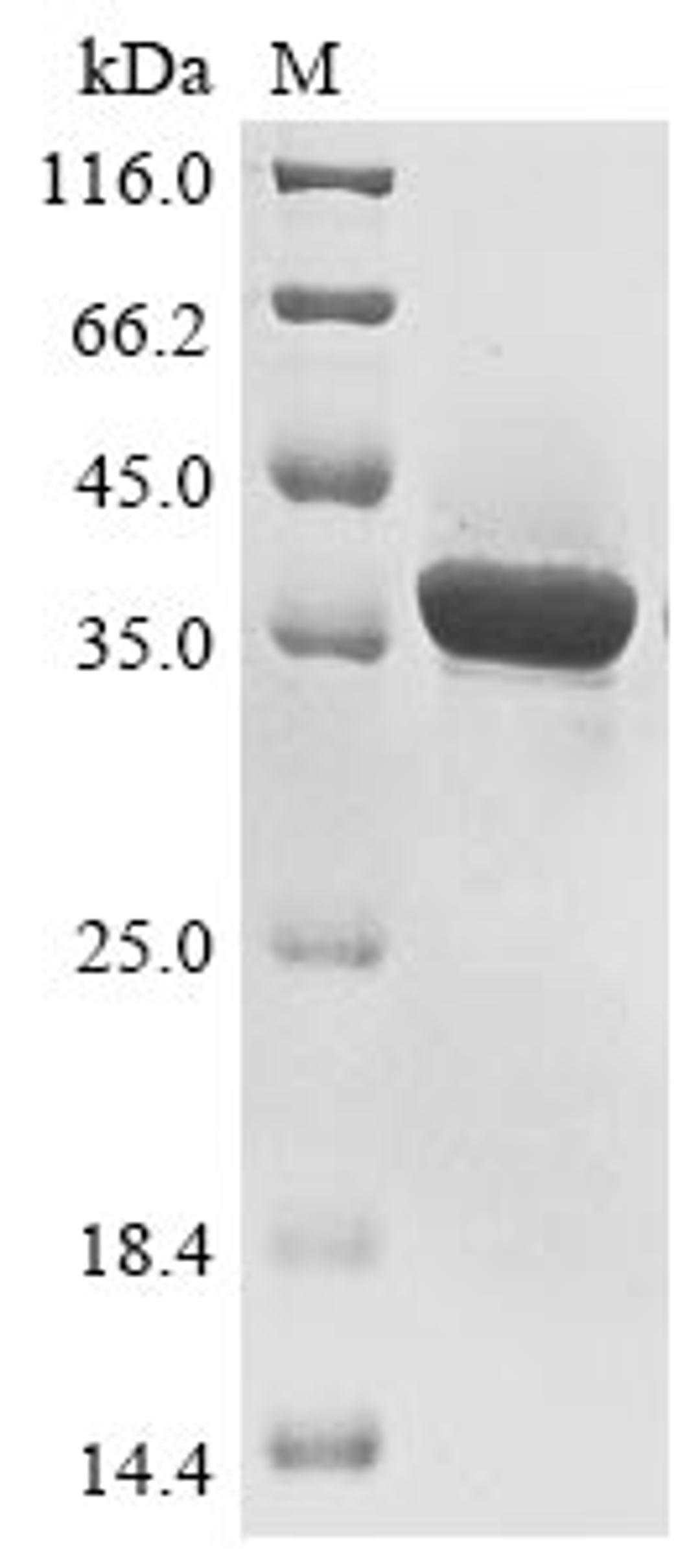 (Tris-Glycine gel) Discontinuous SDS-PAGE (reduced) with 5% enrichment gel and 15% separation gel.