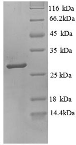 (Tris-Glycine gel) Discontinuous SDS-PAGE (reduced) with 5% enrichment gel and 15% separation gel.