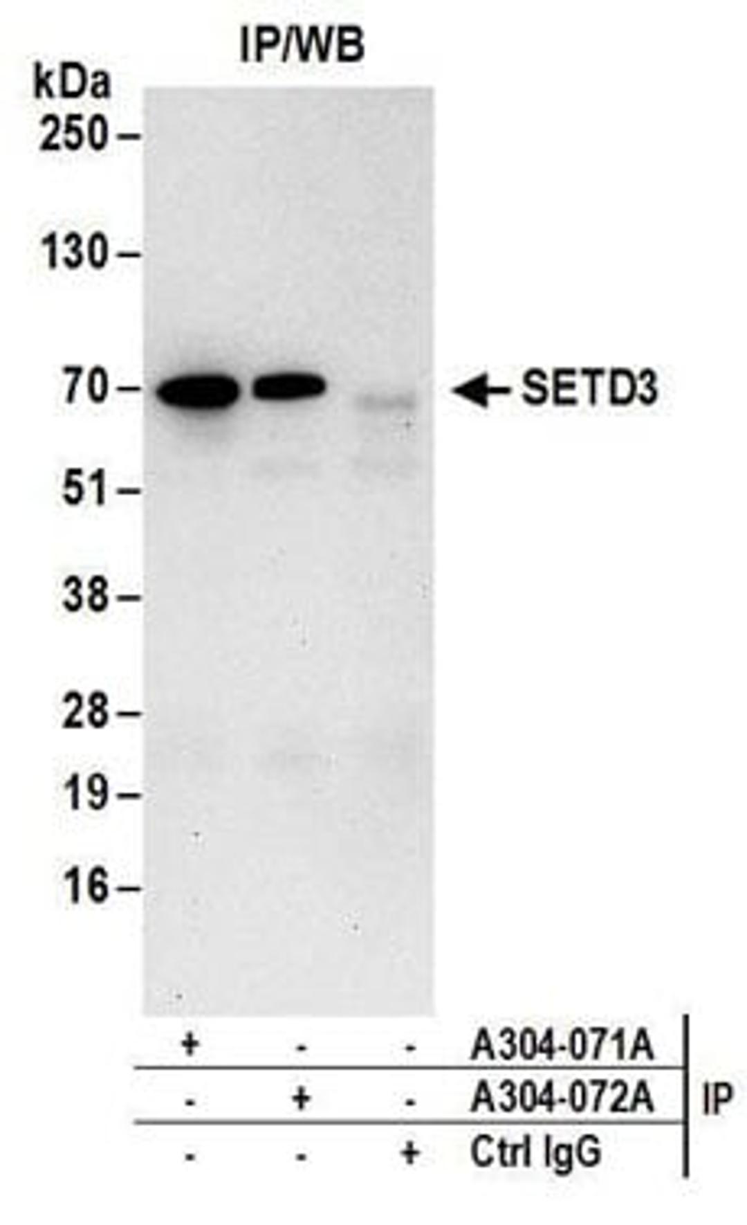 Detection of human SETD3 by western blot of immunoprecipitates.